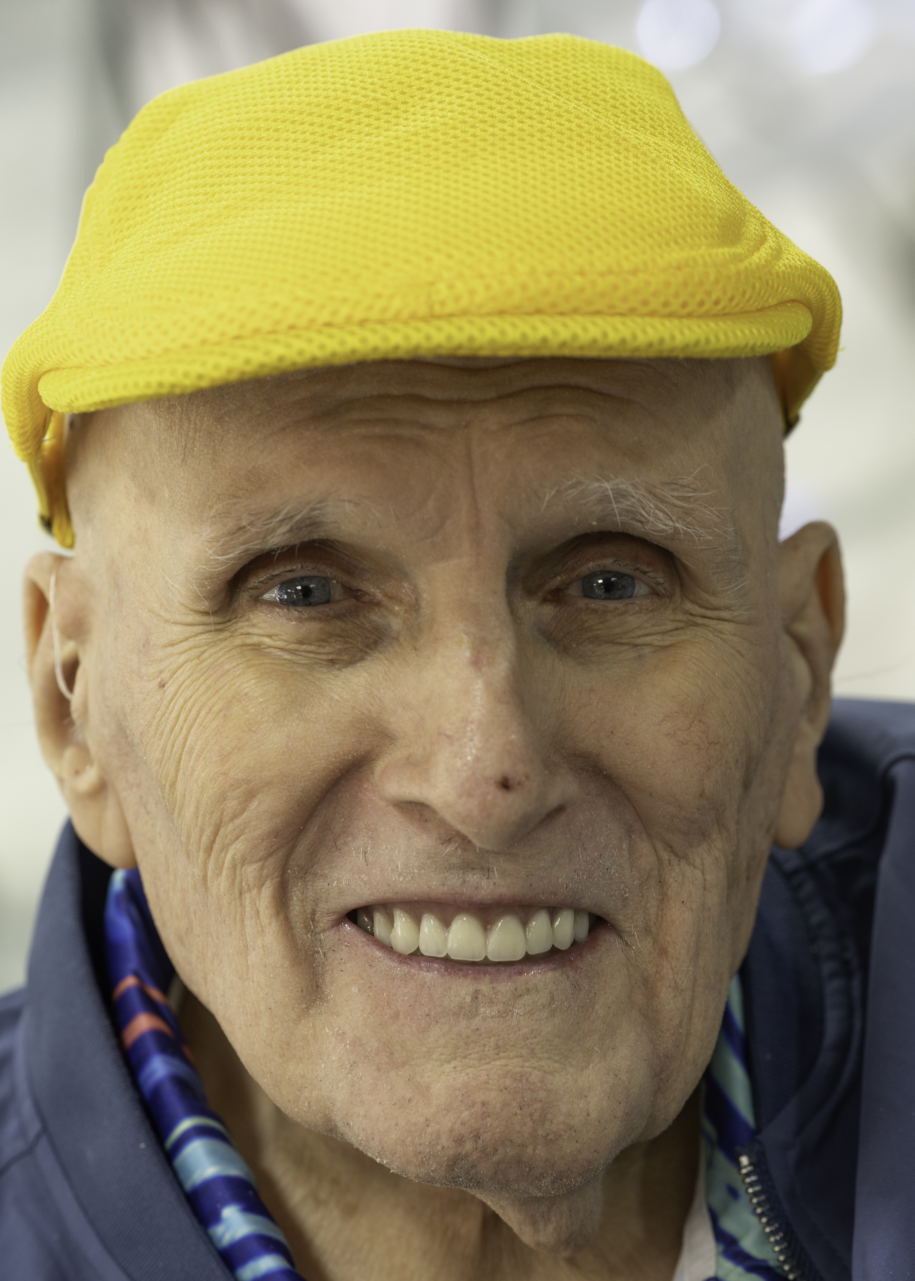 Dentures case — Full dentures restore a complete smile and comfortable bite, treated by Dr. Kambez Shukoor in Washington, DC — after treatment